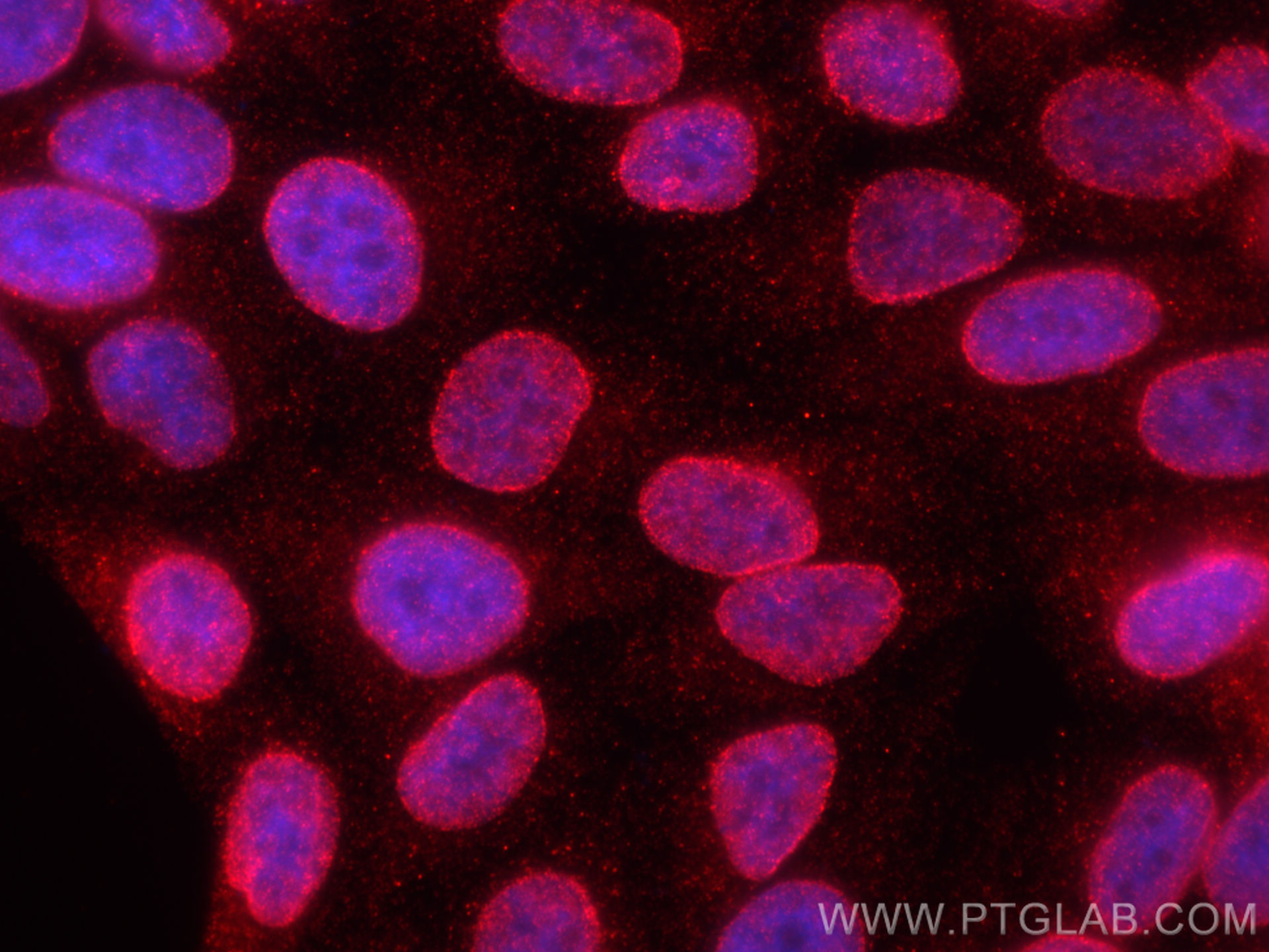 IF Staining of HepG2 using 11102-1-AP