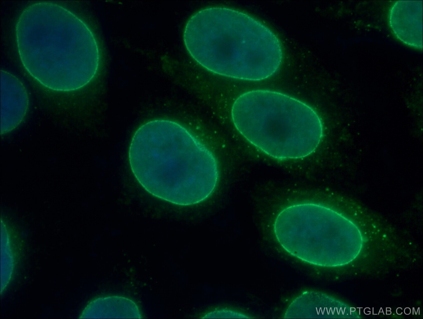 IF Staining of HepG2 using 11102-1-AP