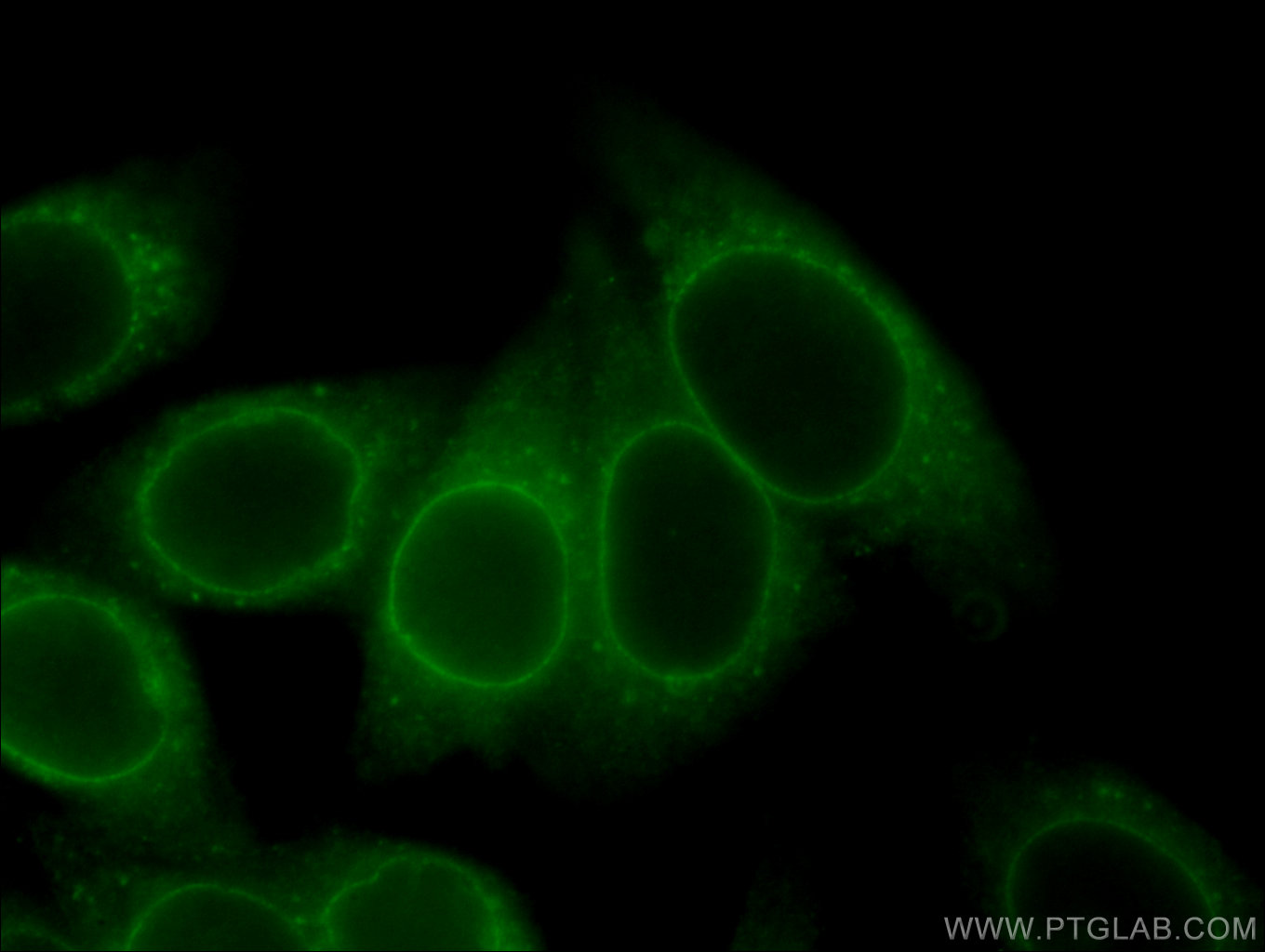 IF Staining of HepG2 using 67146-1-Ig