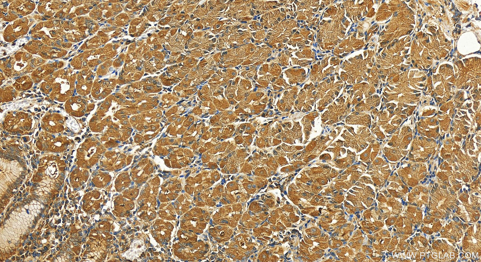 Immunohistochemical analysis of paraffin-embedded human stomach tissue slide using 16336-1-AP (RAP1A antibody) at dilution of 1:300 (under 20x lens). Heat mediated antigen retrieval with Tris-EDTA buffer (pH 9.0). IHC staining of human stomach using 16336-1-AP