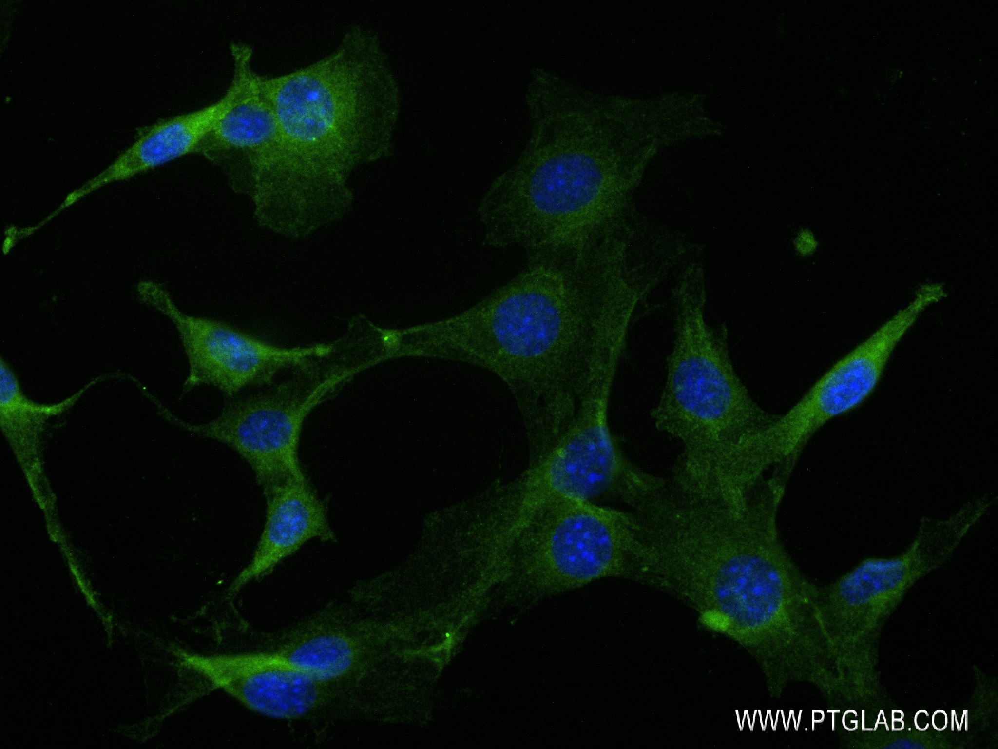 IF Staining of NIH/3T3 using 83708-1-RR (same clone as 83708-1-PBS)