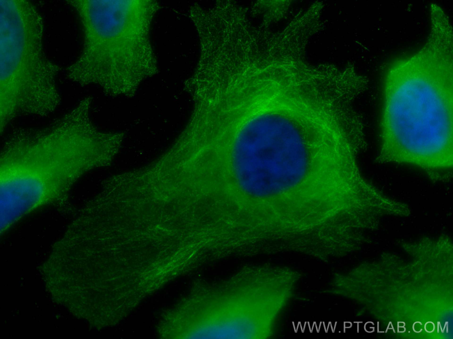 IF Staining of HeLa using 67174-1-Ig