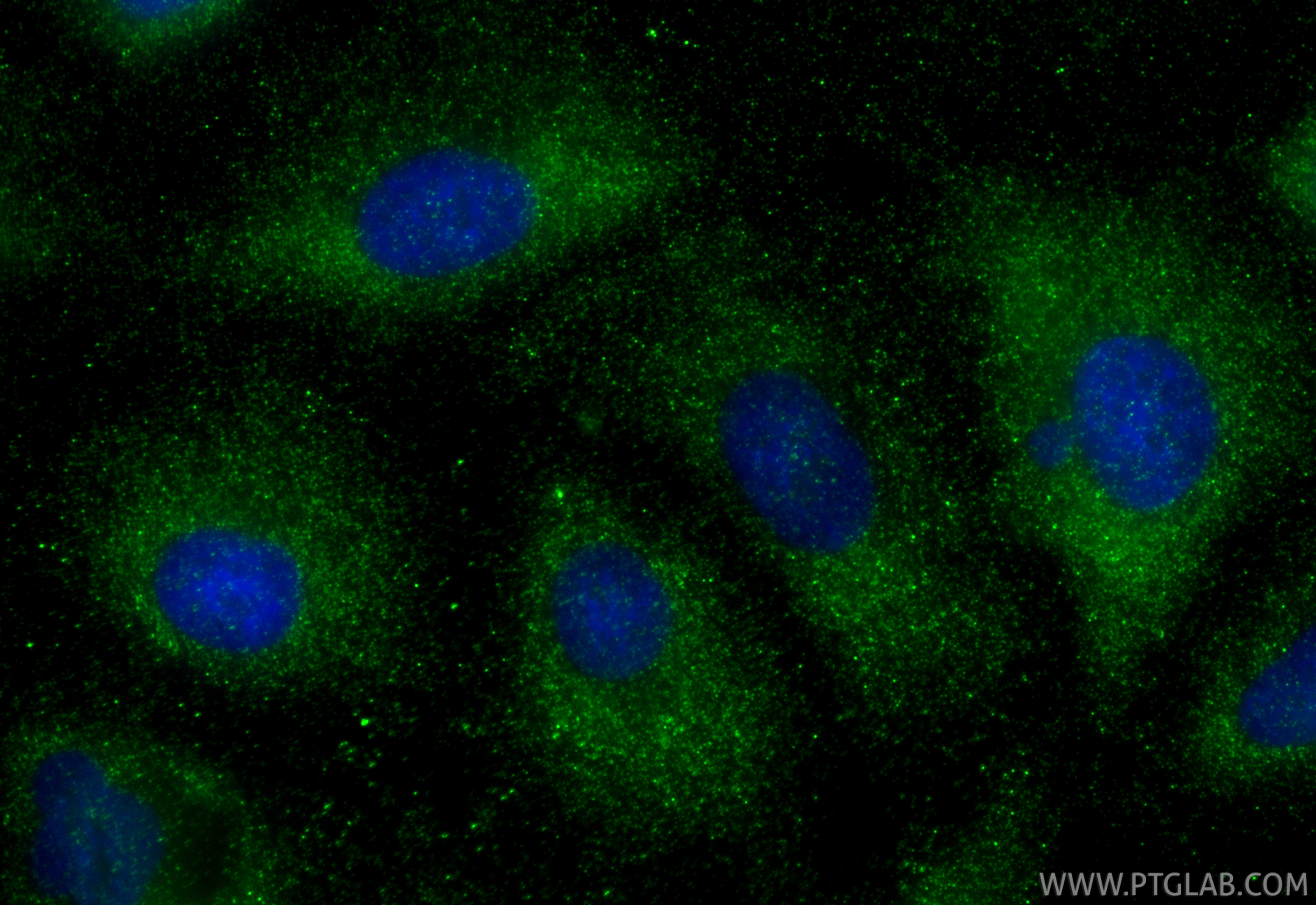 IF Staining of A549 using 88443-1-RR IF Staining of A549 using 88443-1-RR