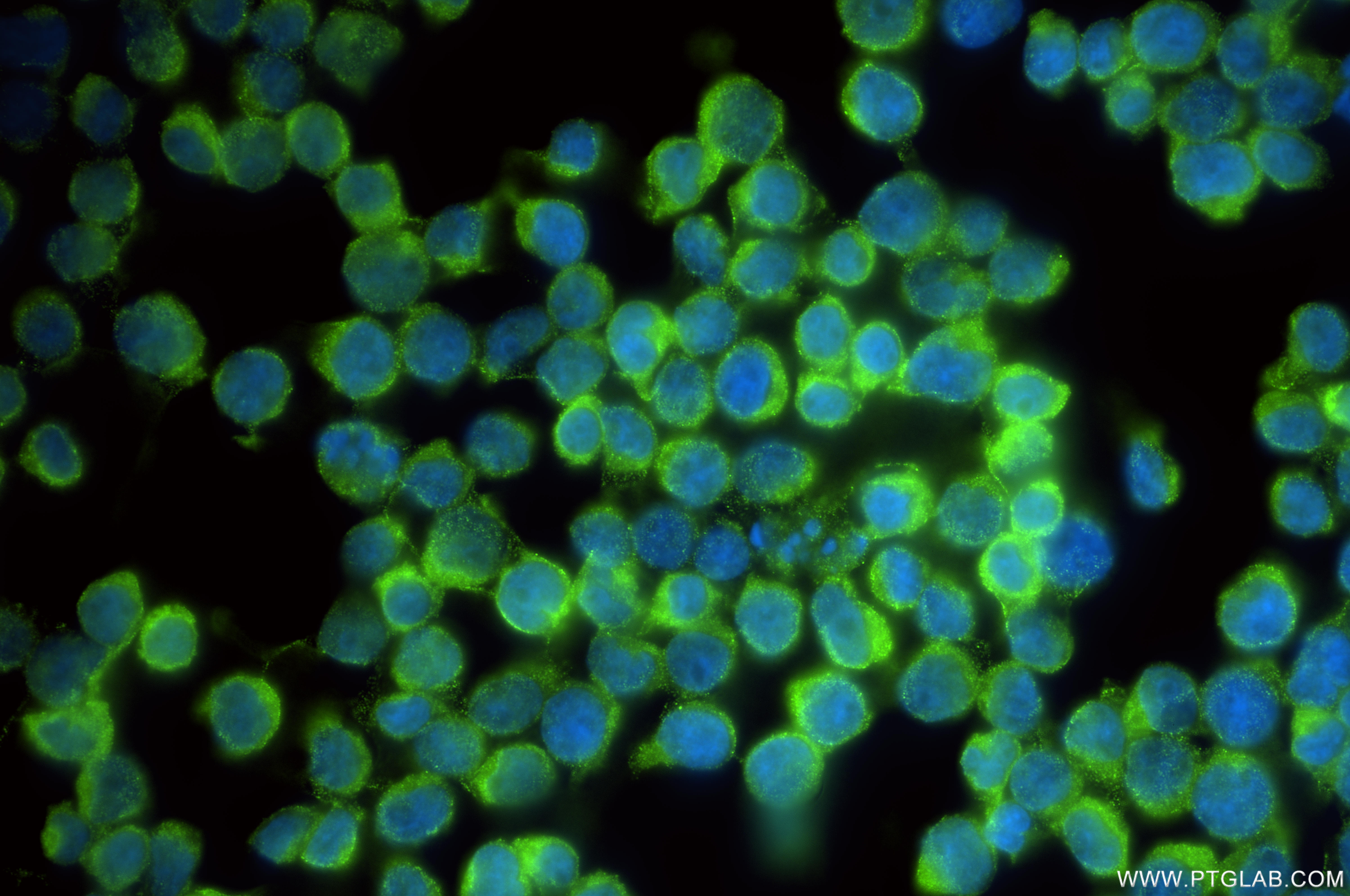 IF Staining of Jurkat using 86011-1-RR (same clone as 86011-1-PBS)