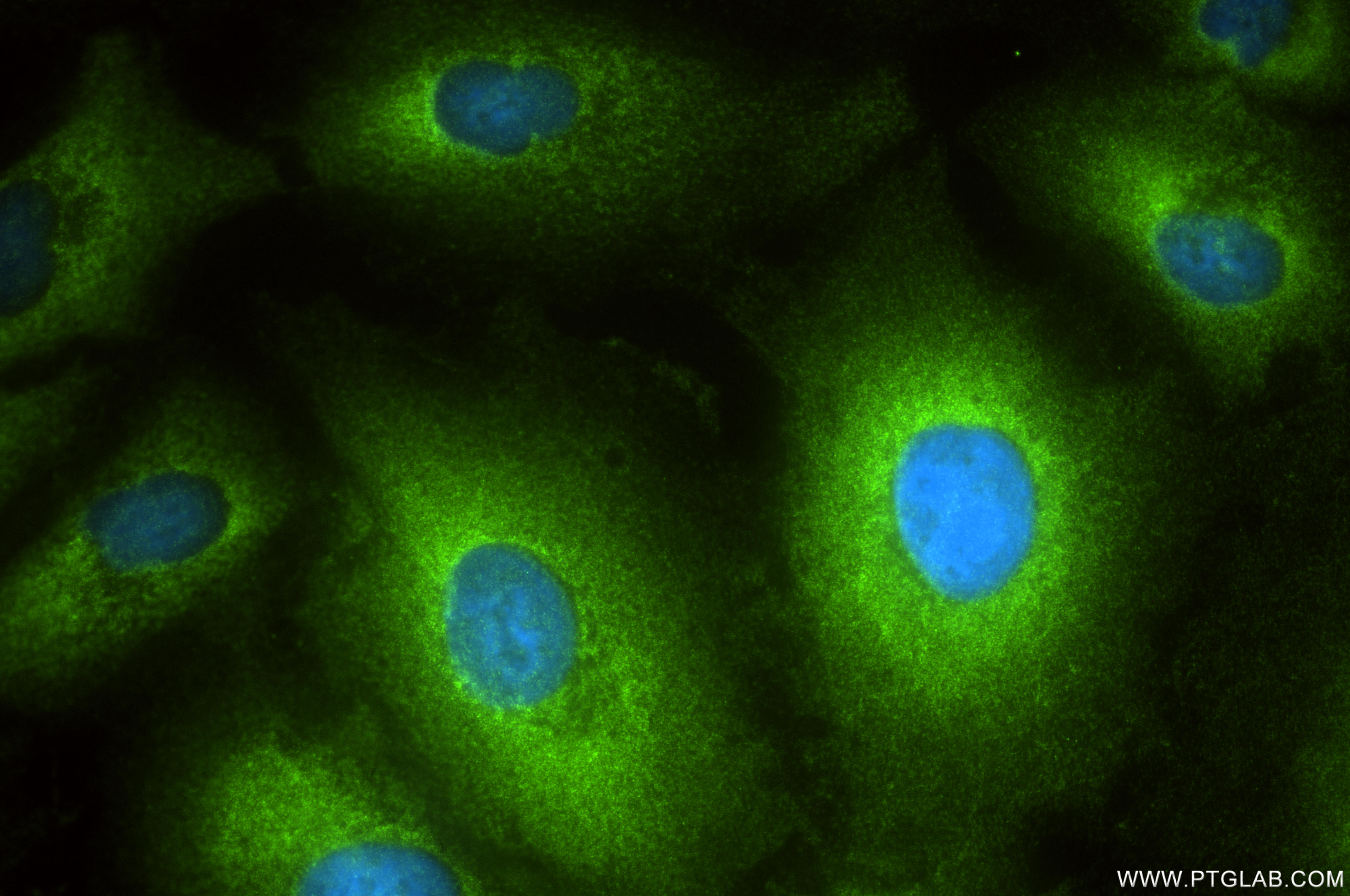 IF Staining of A549 using 86011-1-RR (same clone as 86011-1-PBS)