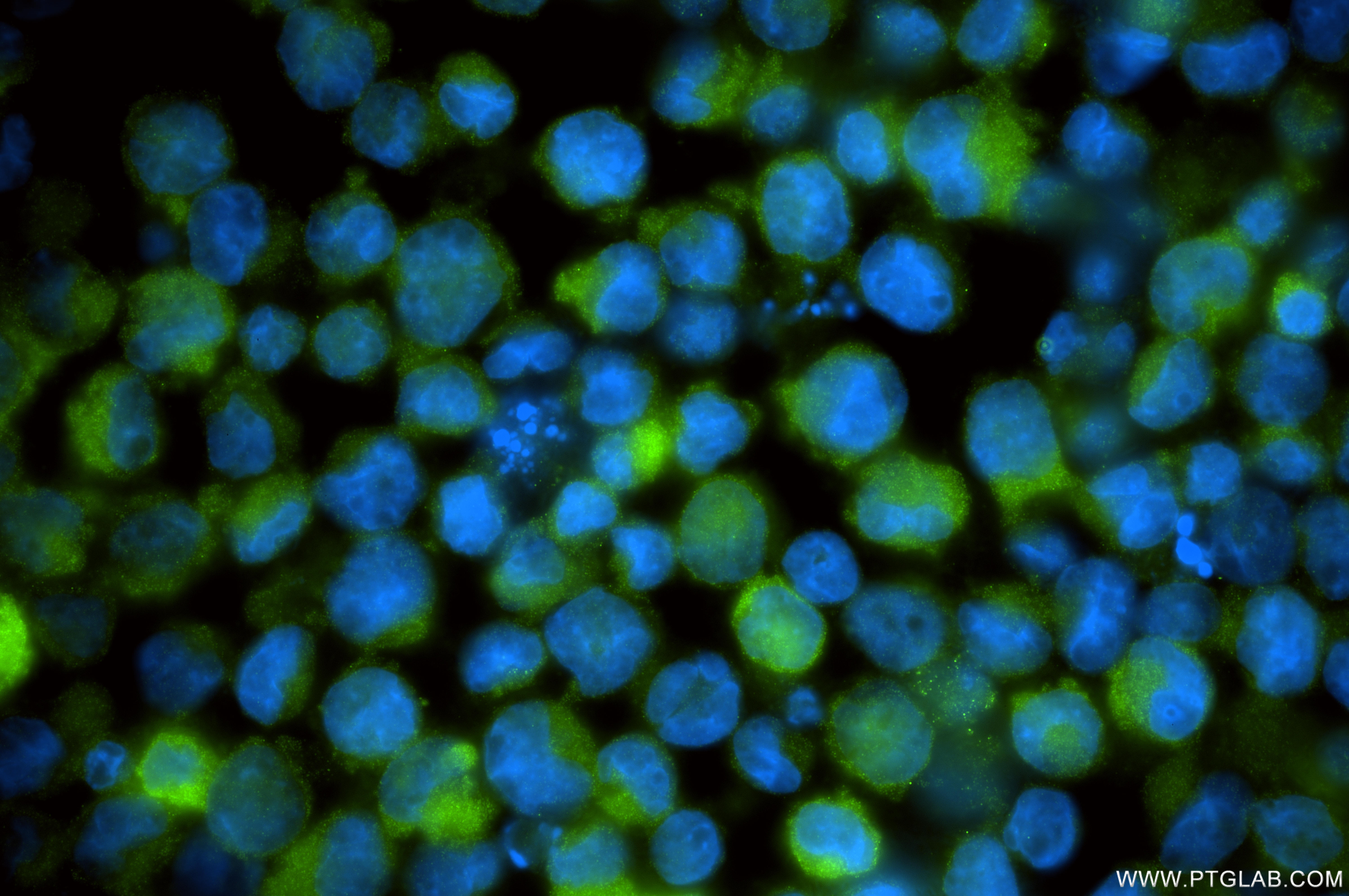 IF Staining of K-562 using 86011-2-RR