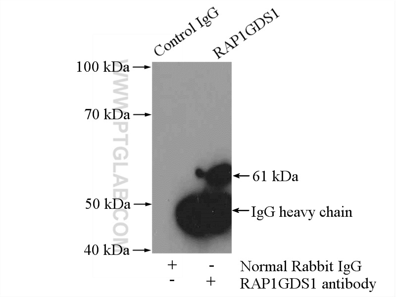 IP experiment of mouse brain using 10377-1-AP