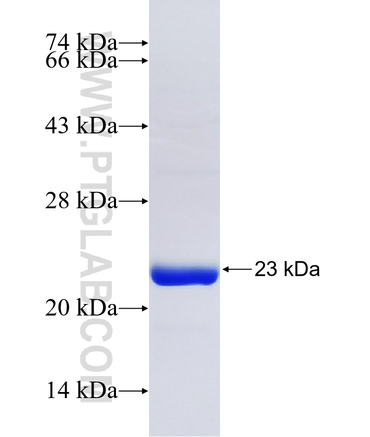 RAPGEF2 fusion protein Ag35334 SDS-PAGE RAPGEF2 fusion protein Ag35334 SDS-PAGE