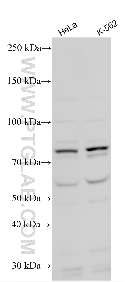 WB analysis using 12556-1-AP