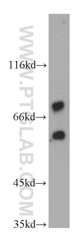 WB analysis of human brain using 21746-1-AP
