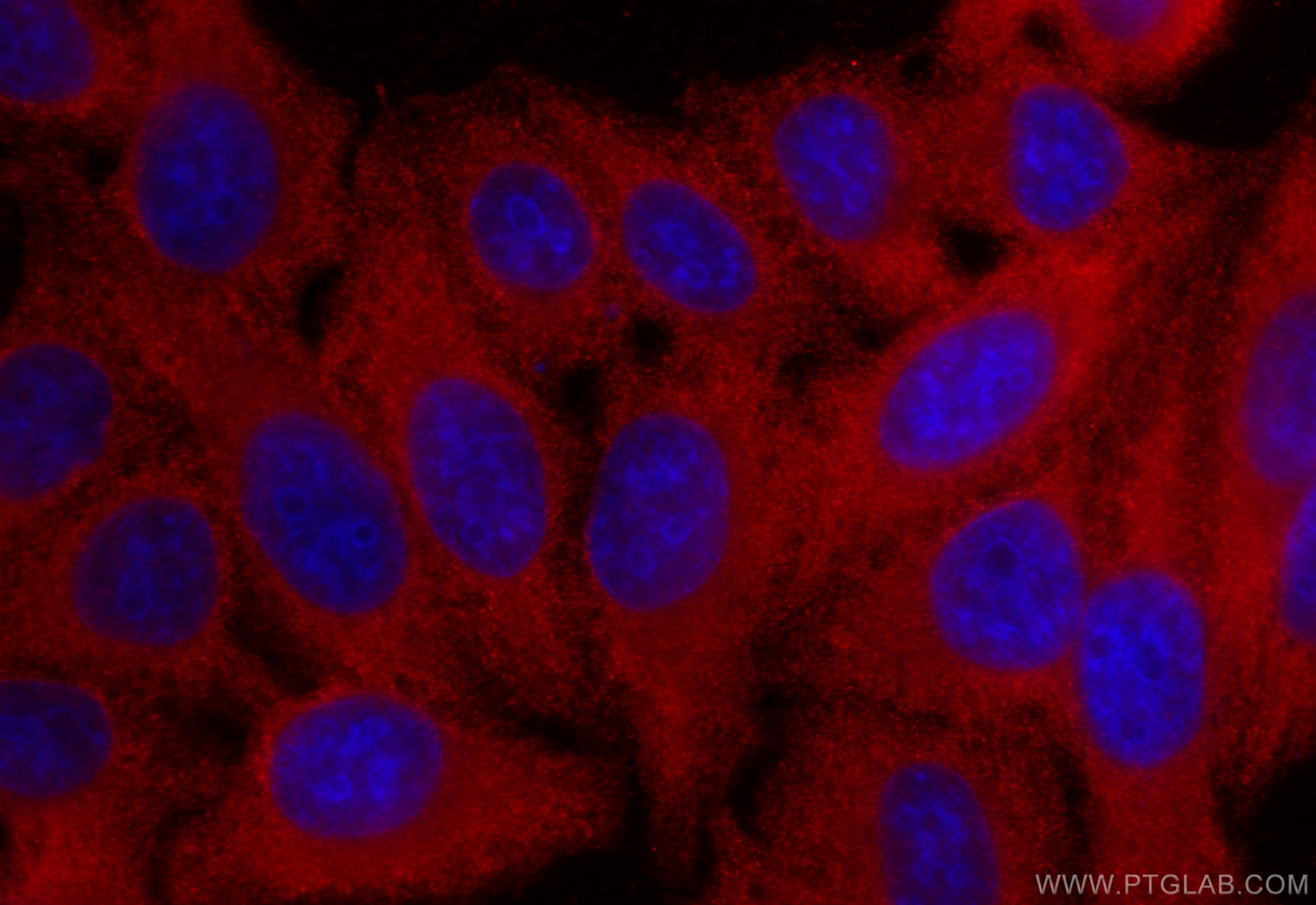 IF Staining of HepG2 using 25750-1-AP