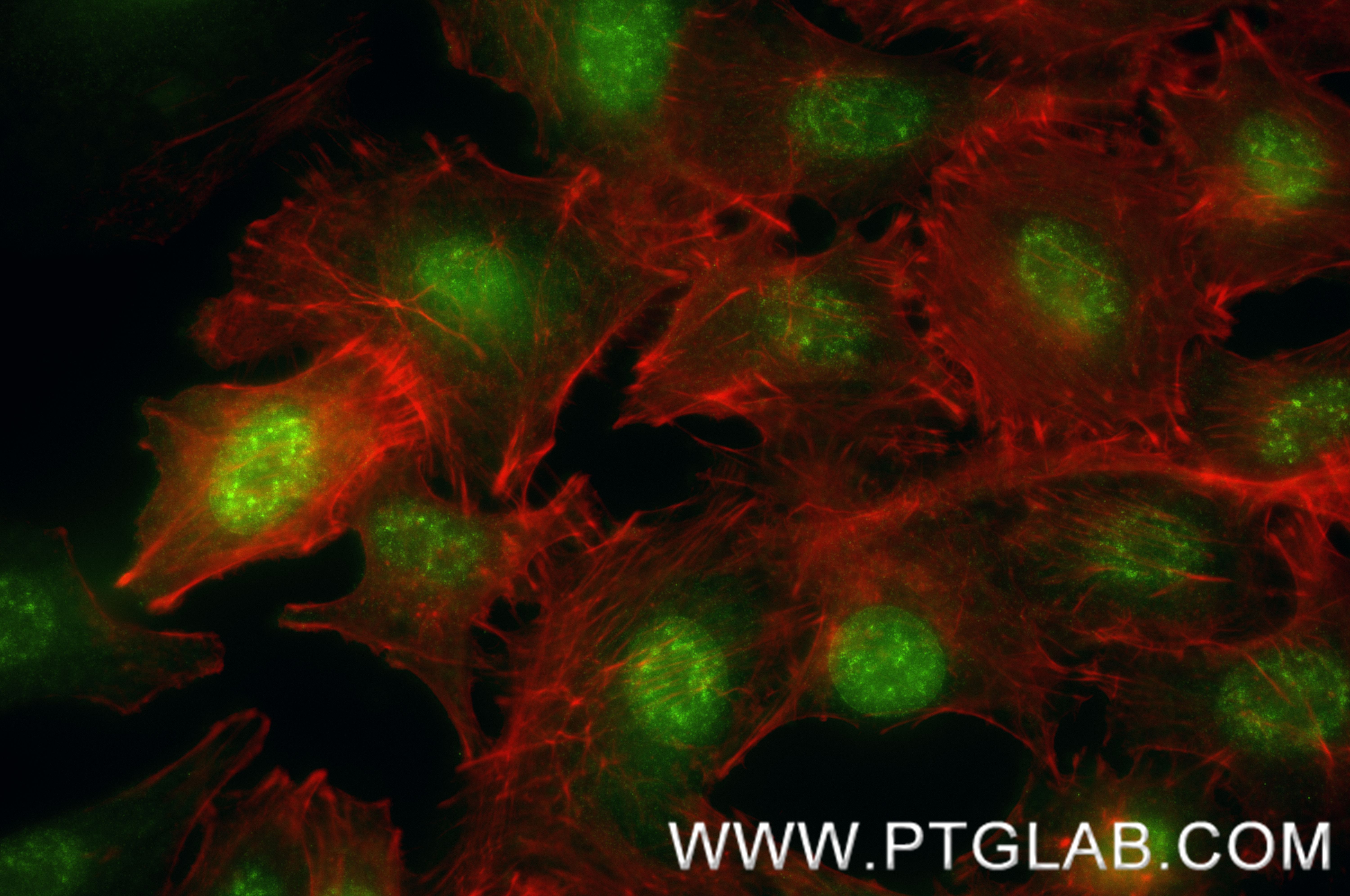 IF Staining of A549 using 88230-1-RR IF Staining of A549 using 88230-1-RR