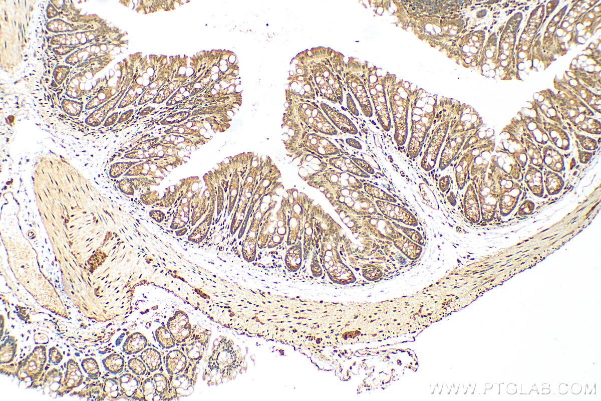 IHC staining of mouse colon using 14013-1-AP