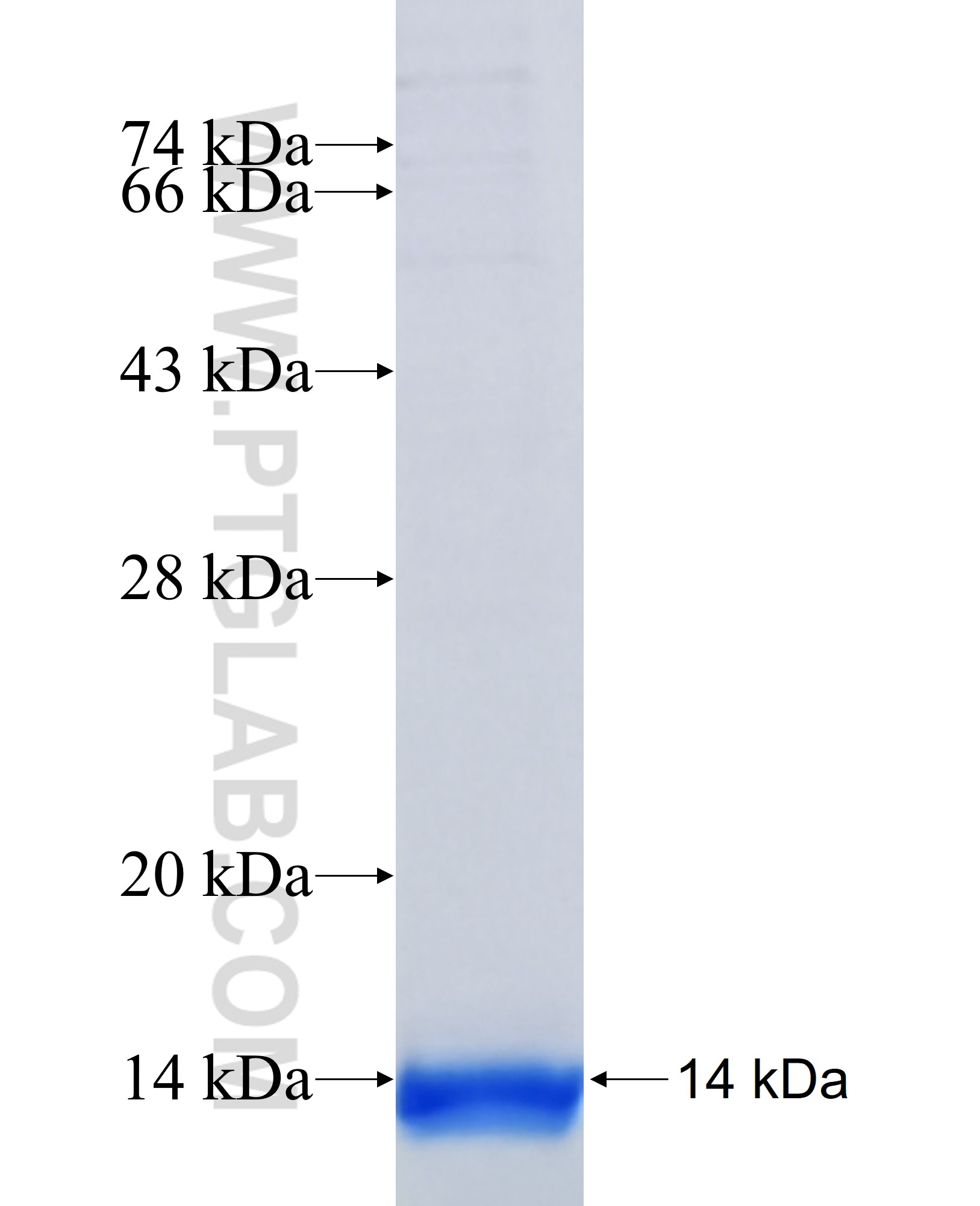 RARB fusion protein Ag39126 SDS-PAGE RARB fusion protein Ag39126 SDS-PAGE