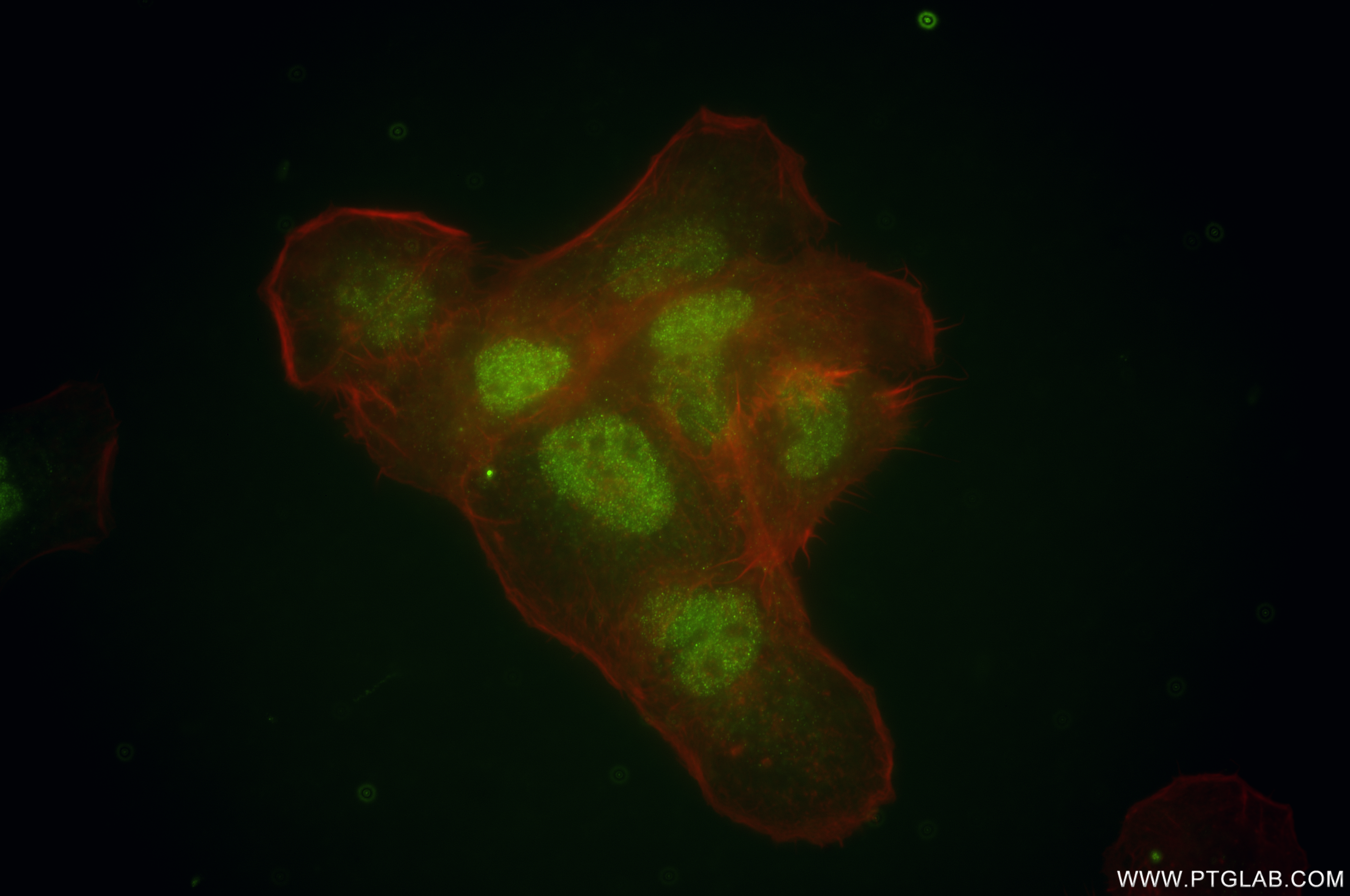 IF Staining of A431 using 86098-1-RR