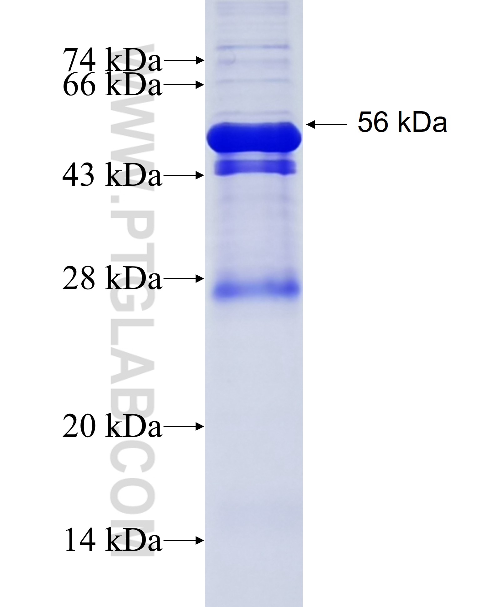 RARRES1 fusion protein Ag26520 SDS-PAGE