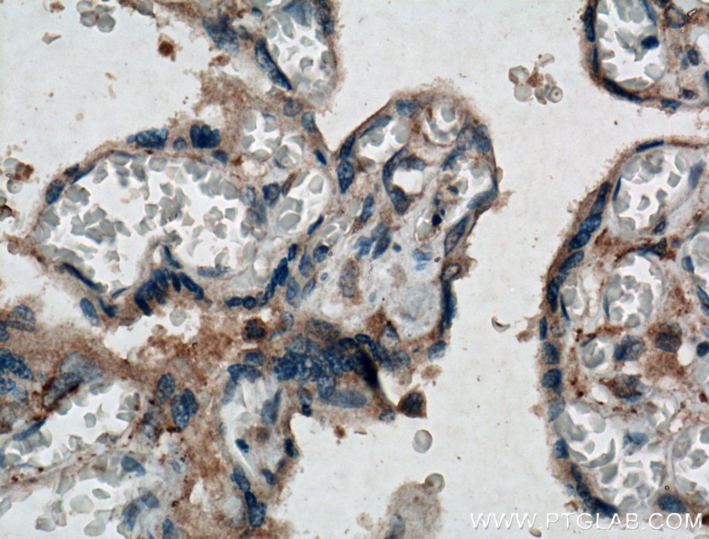 IHC staining of human placenta using 10216-1-AP