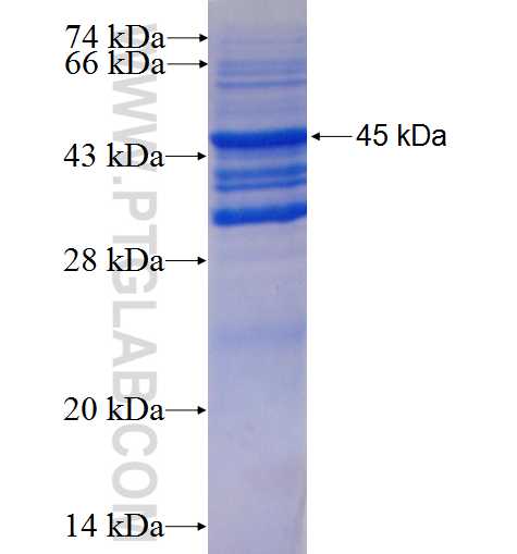 RARRES2 fusion protein Ag0261 SDS-PAGE