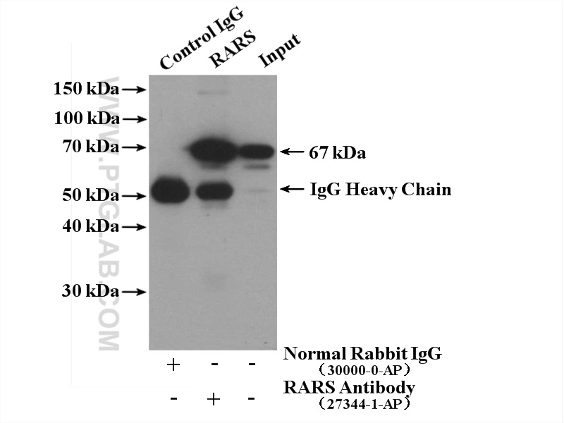 IP experiment of HeLa using 27344-1-AP