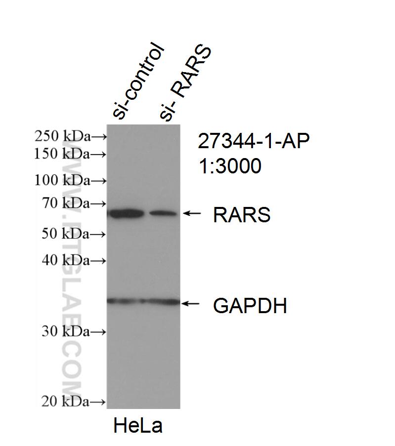 WB analysis of HeLa using 27344-1-AP