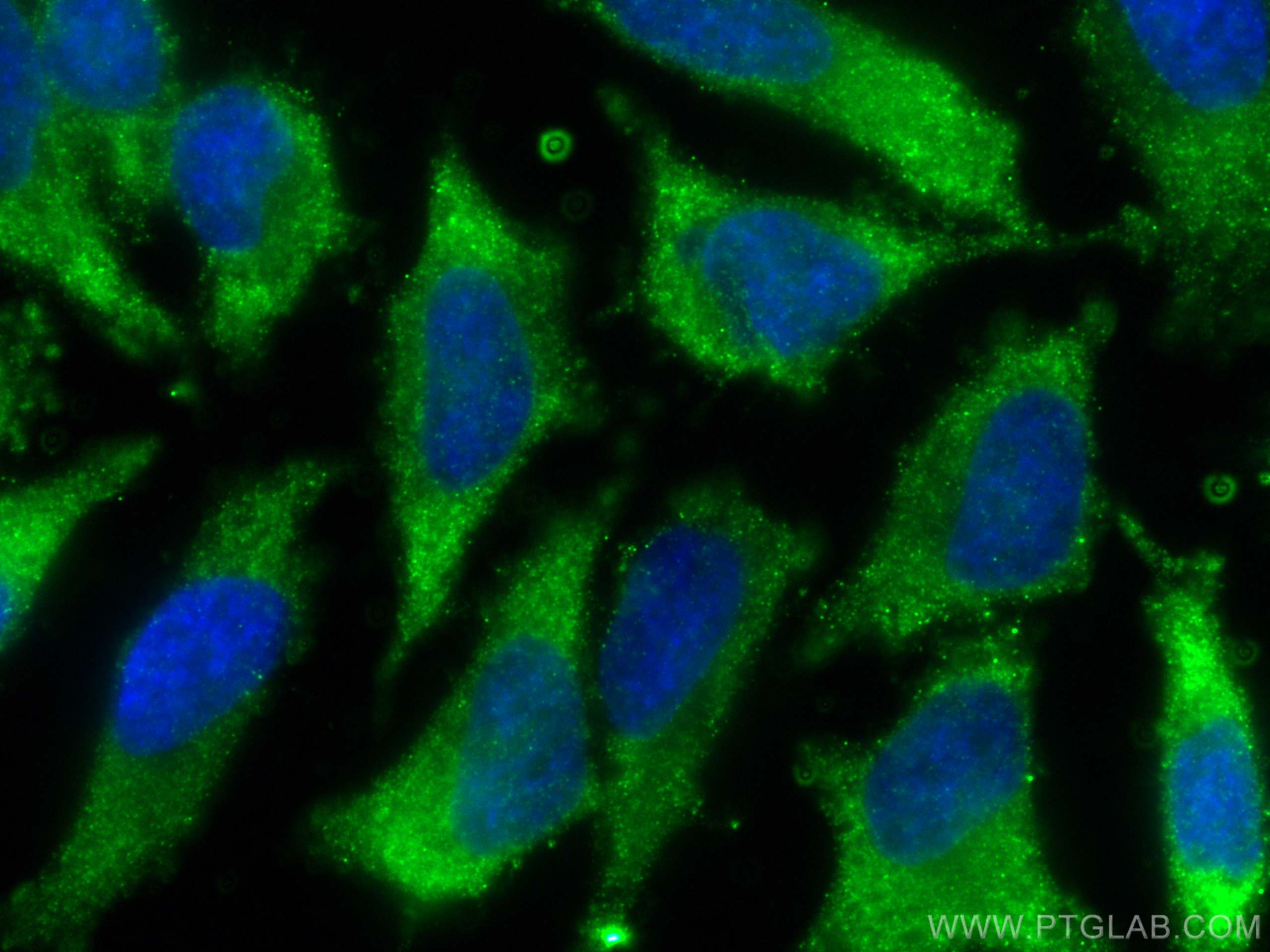 IF Staining of HeLa using 66815-1-Ig