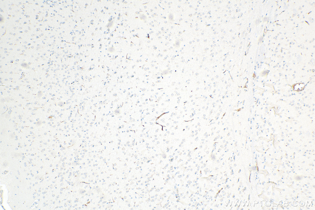 IHC staining of mouse brain using 66815-1-Ig