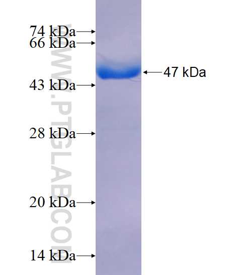 RARS fusion protein Ag26390 SDS-PAGE