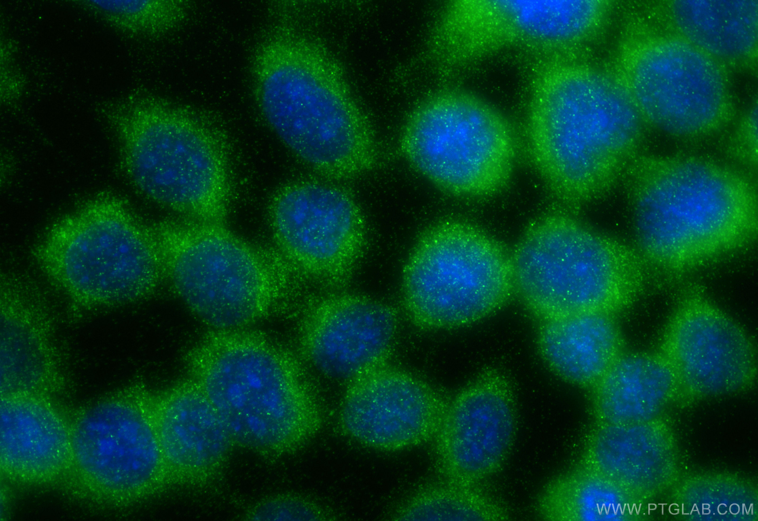 IF Staining of A431 using 31586-1-AP