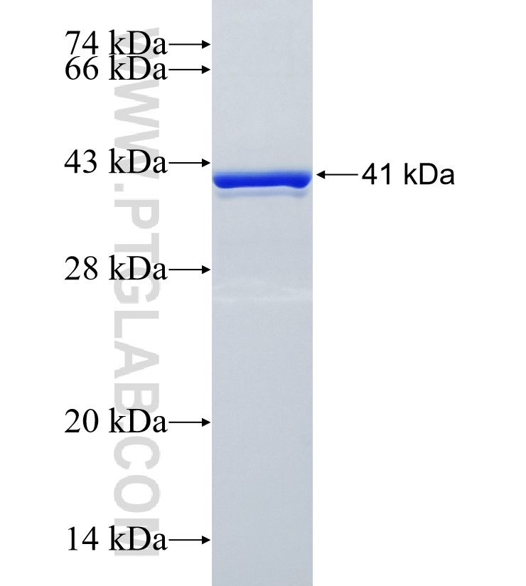 RASA4B fusion protein Ag35038 SDS-PAGE
