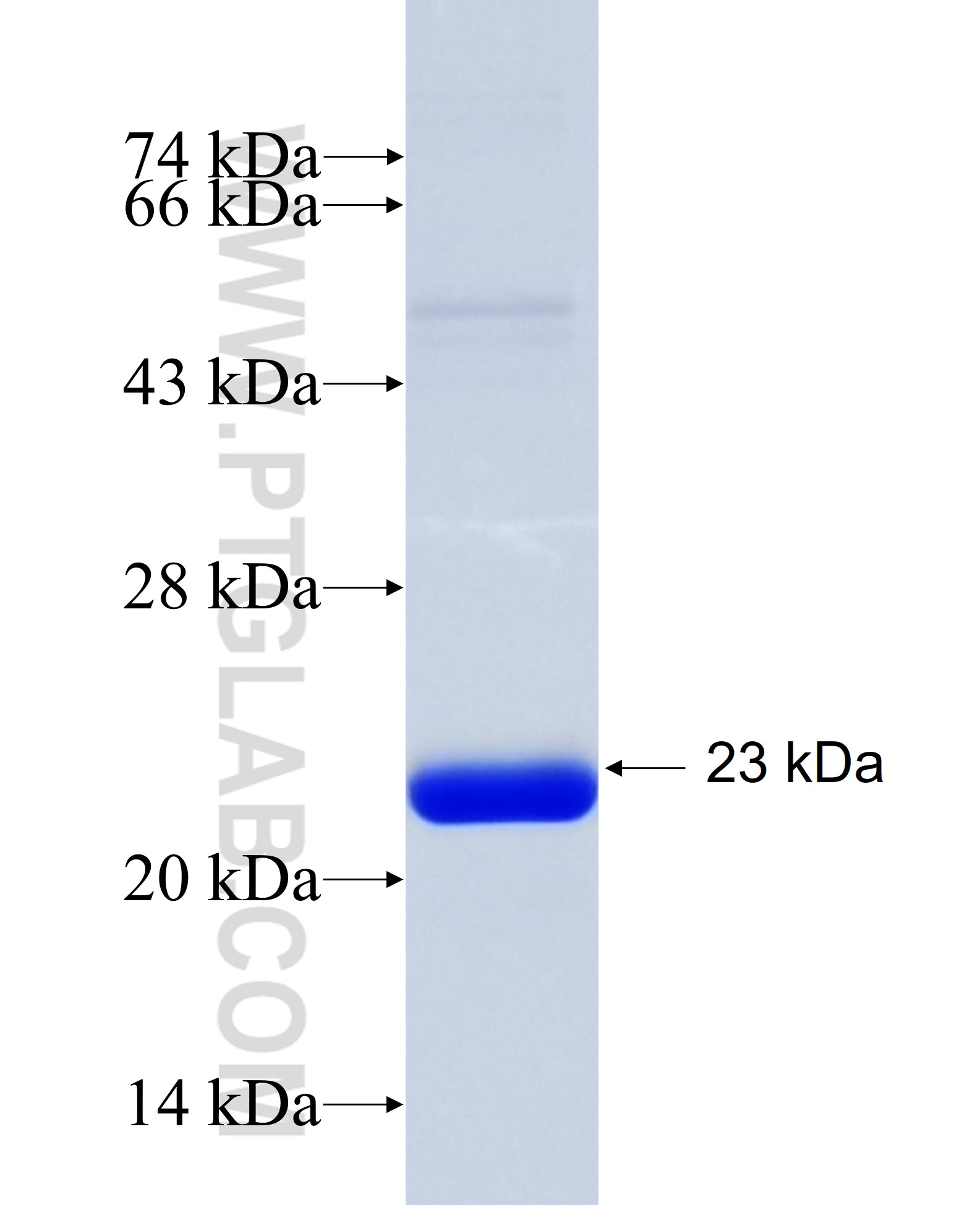 RASA4B fusion protein Ag35053 SDS-PAGE RASA4B fusion protein Ag35053 SDS-PAGE