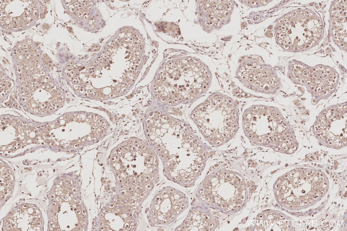 IHC staining of human testis using 22140-1-AP