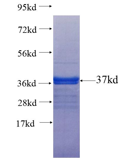 RASD2 fusion protein Ag25829 SDS-PAGE