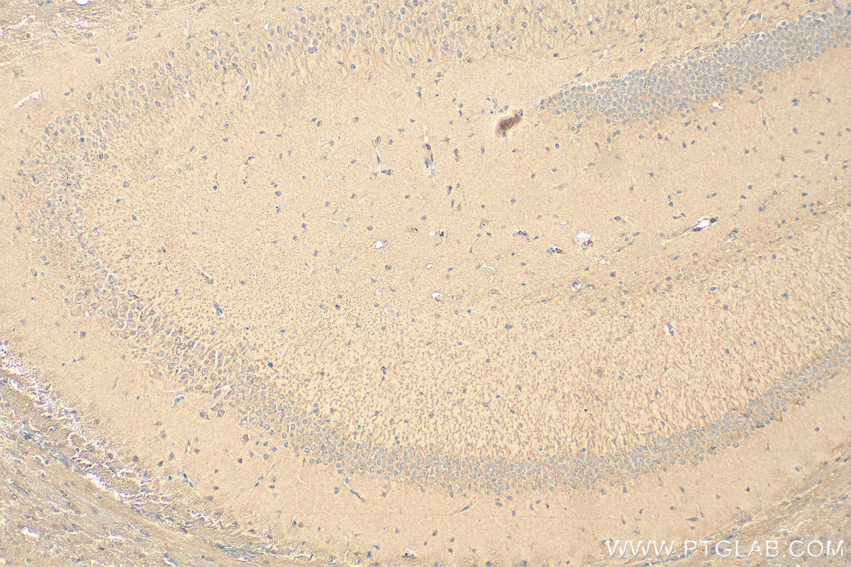 IHC staining of mouse brain using 11569-1-AP