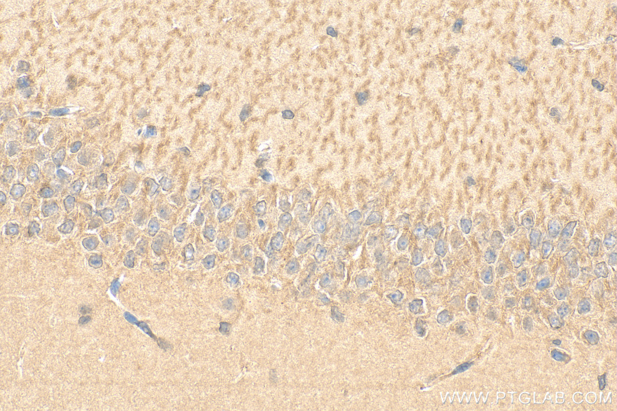 IHC staining of mouse brain using 11569-1-AP