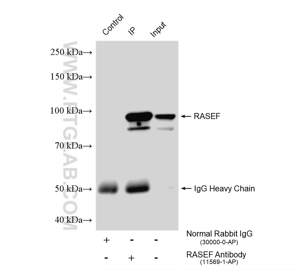 IP experiment of mouse testis using 11569-1-AP