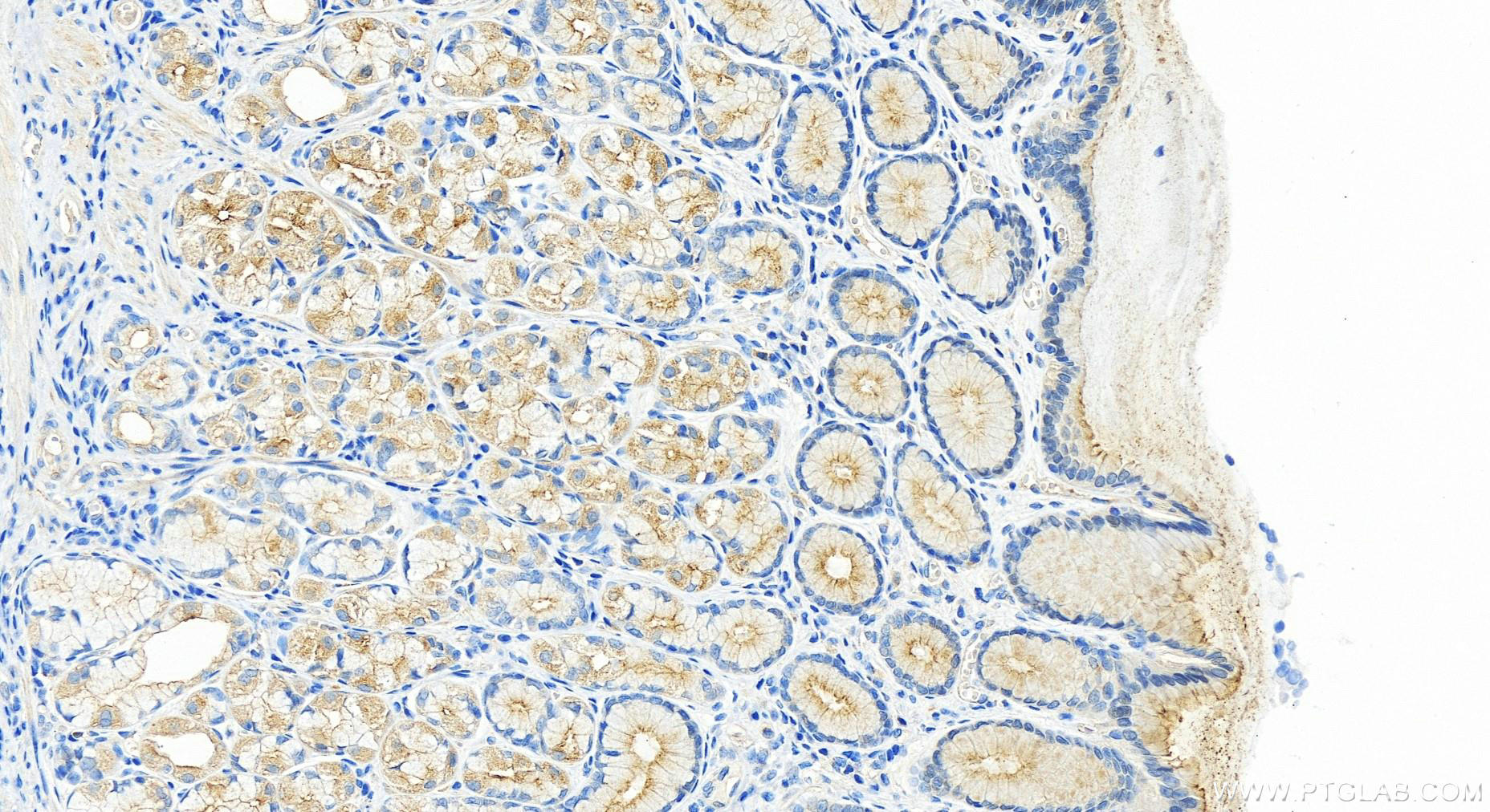 IHC staining of human stomach using 28162-1-AP
