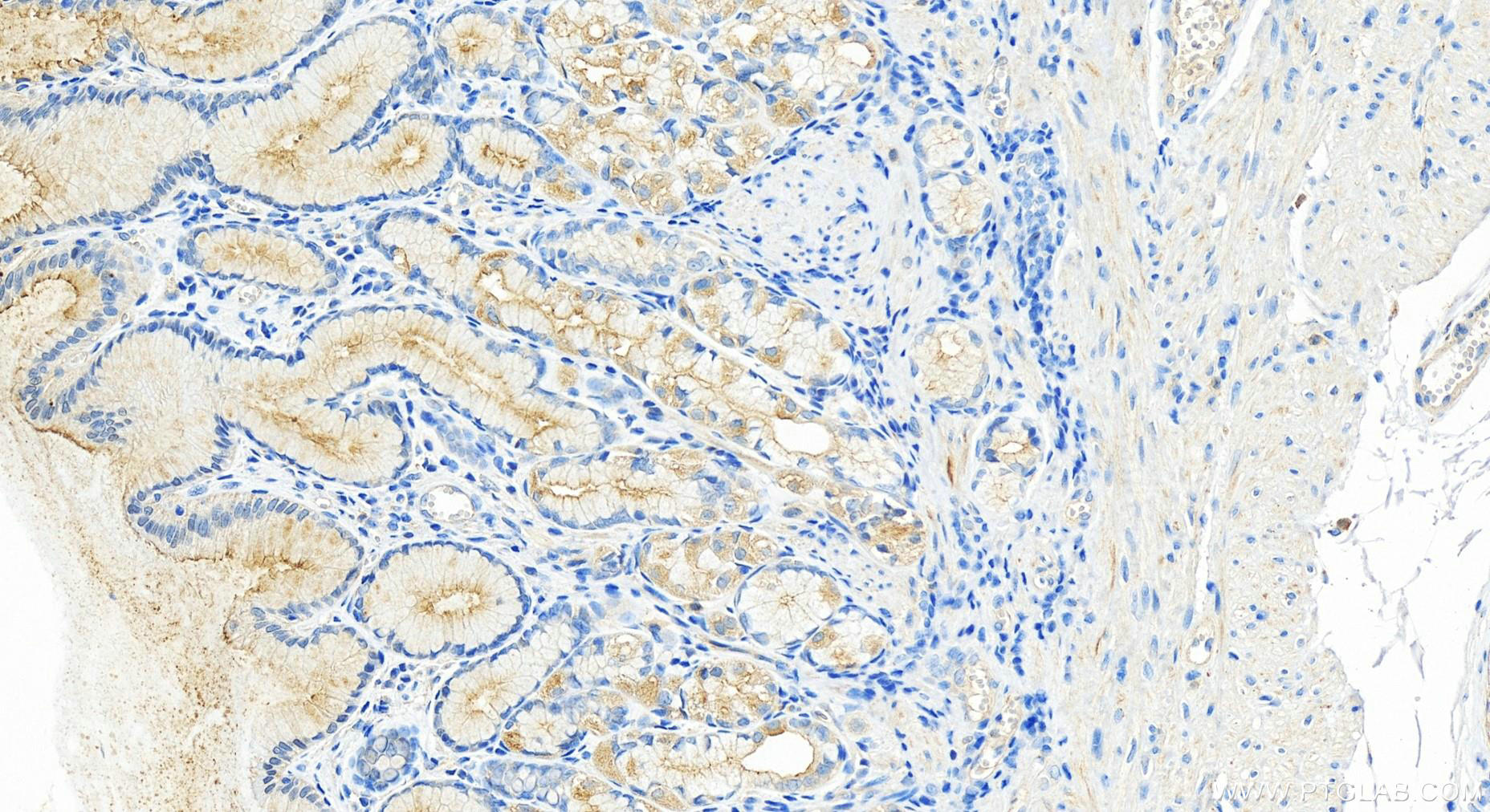 IHC staining of human stomach using 28162-1-AP
