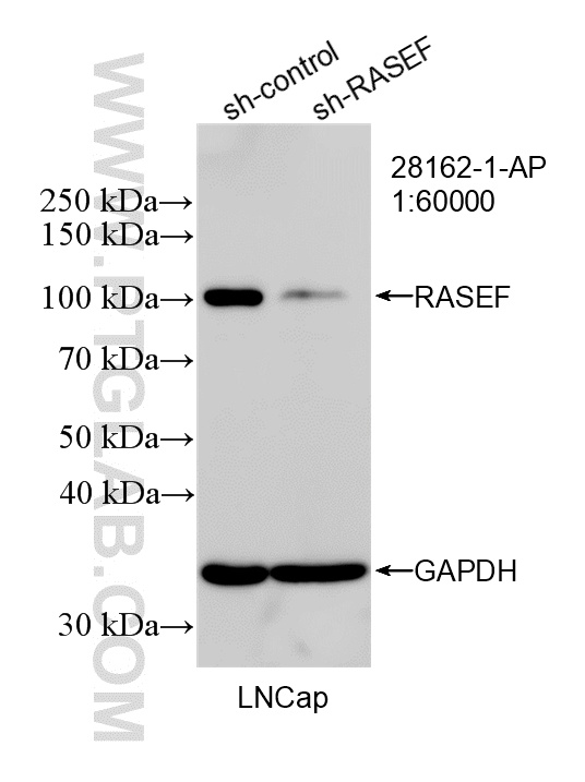 WB result of RASEF antibody (28162-1-AP; 1:60000; incubated at room temperature for 1.5 hours) with sh-Control and sh-RASEF transfected LNCaP cells. WB analysis of LNCaP using 28162-1-AP
