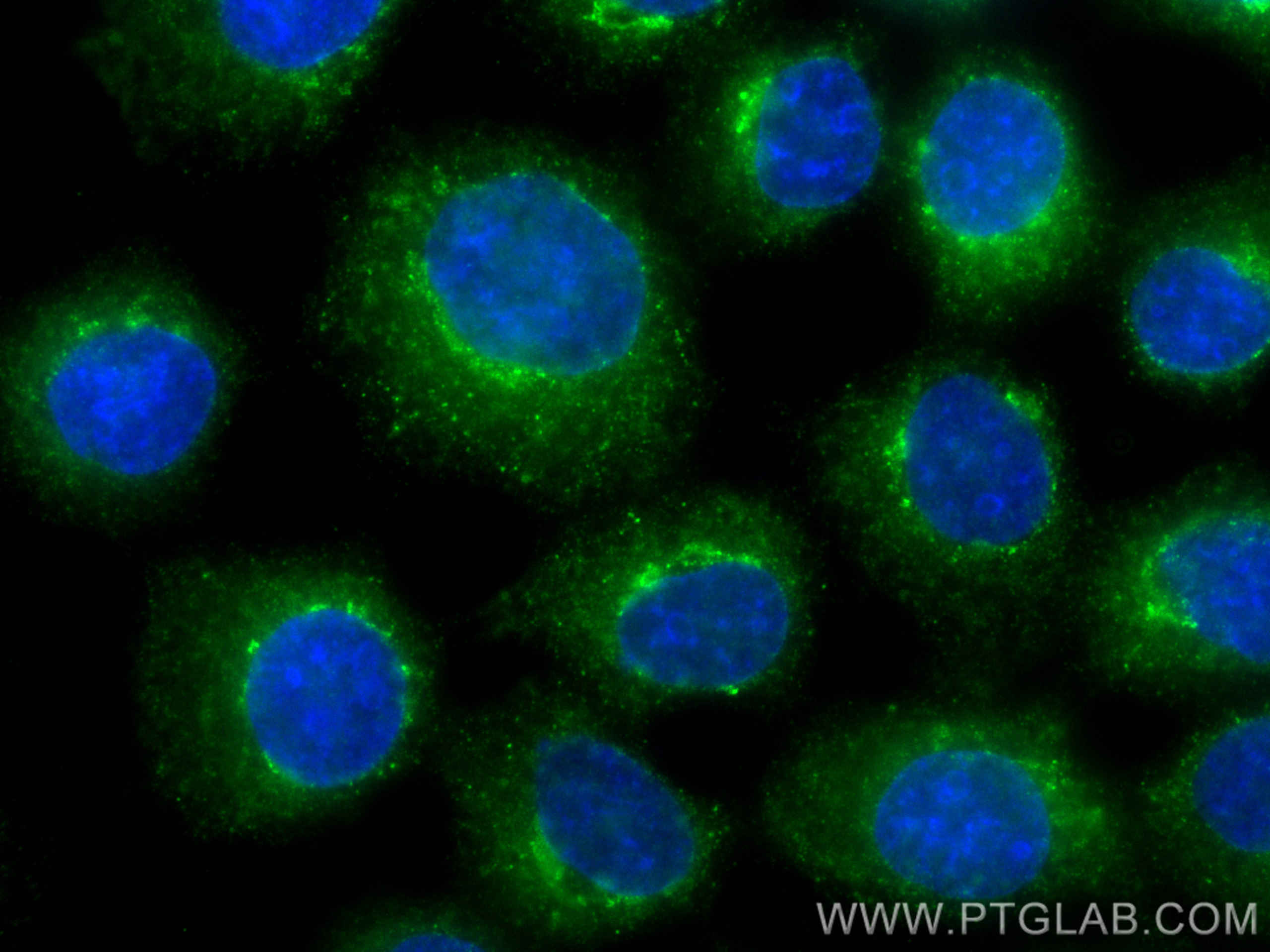 IF Staining of A431 using 67159-1-Ig (same clone as 67159-1-PBS)