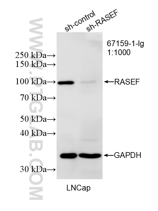 WB result of RASEF antibody (67159-1-Ig; 1:1000; incubated at room temperature for 1.5 hours) with sh-Control and sh-RASEF transfected LNCaP cells. WB analysis of LNCaP using 67159-1-Ig