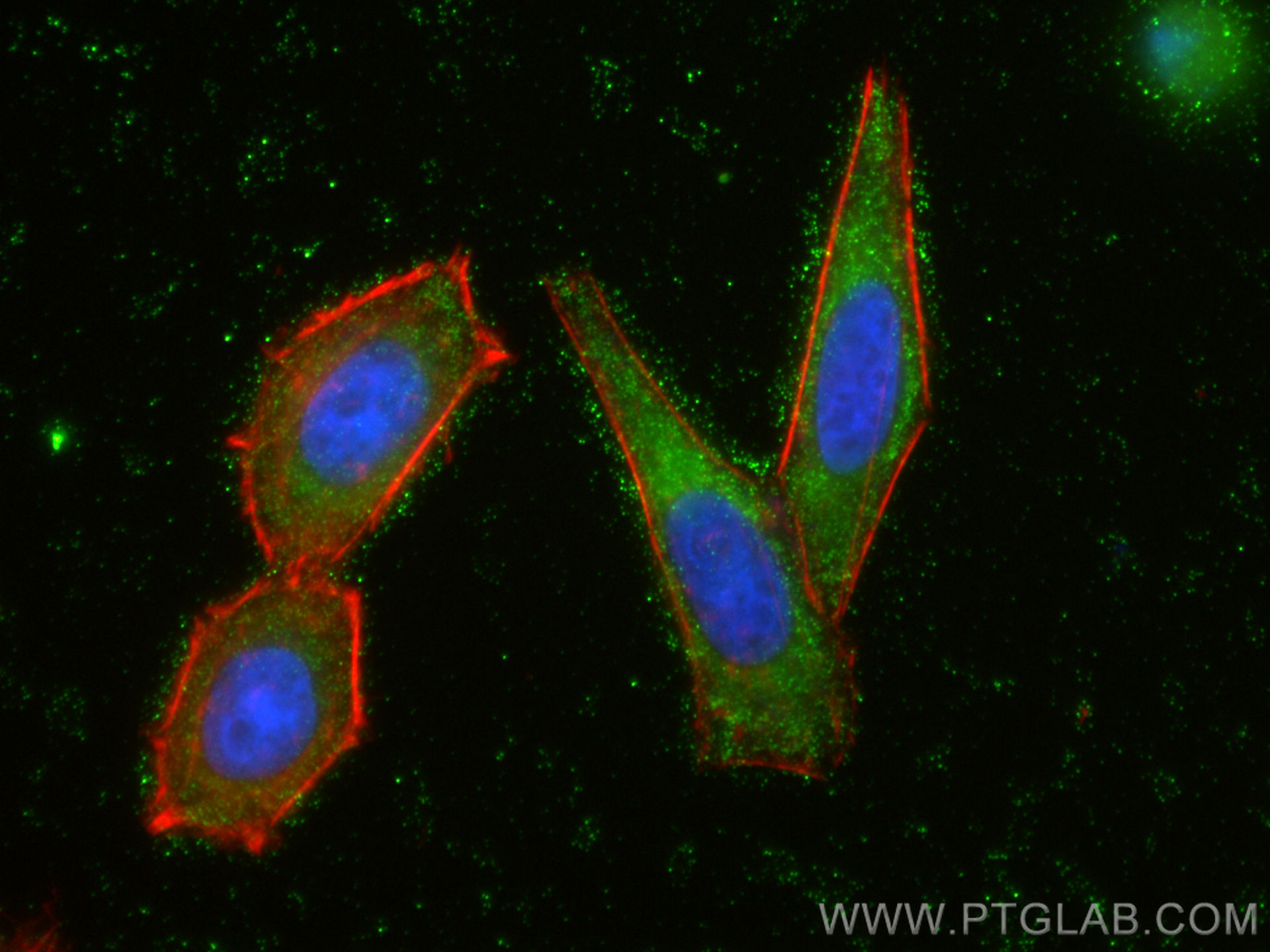 IF Staining of HepG2 using 26997-1-AP
