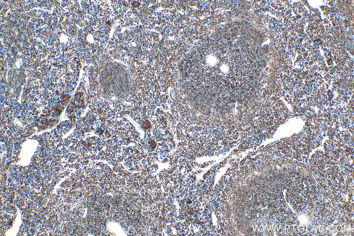 IHC staining of mouse spleen using 30189-1-AP