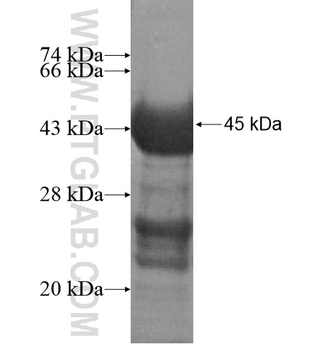 RASGRP4 fusion protein Ag15524 SDS-PAGE RASGRP4 fusion protein Ag15524 SDS-PAGE