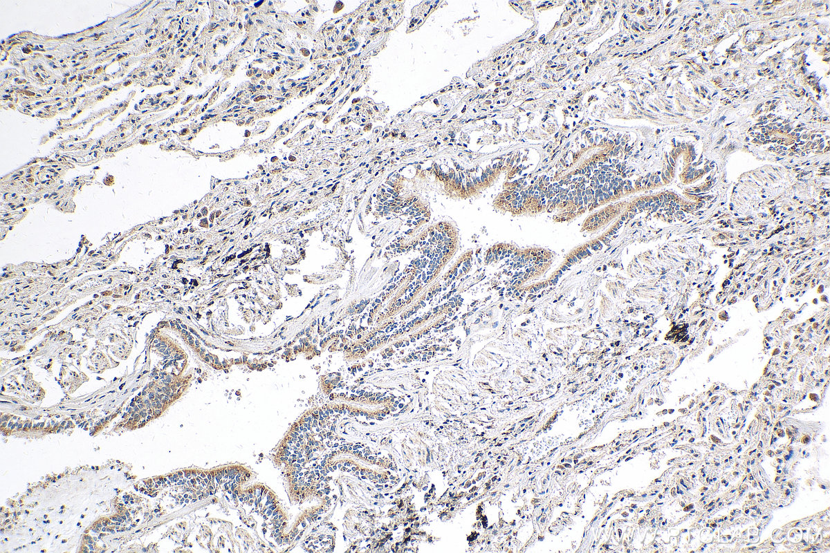 IHC staining of human lung using 17971-1-AP