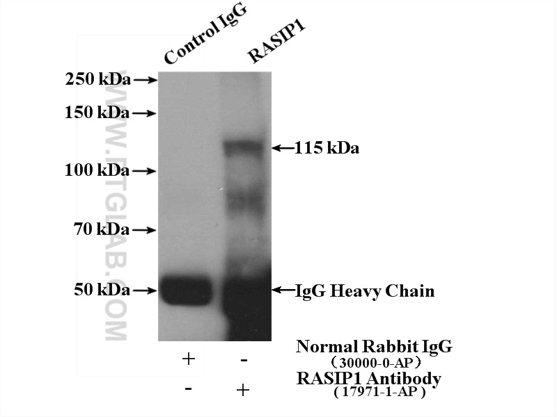 IP experiment of mouse lung using 17971-1-AP