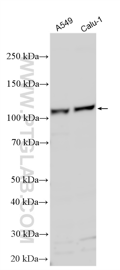 Various lysates were subjected to SDS PAGE followed by western blot with 26064-1-AP (RASIP1 antibody) at dilution of 1:1000 incubated at room temperature for 1.5 hours. WB analysis using 26064-1-AP