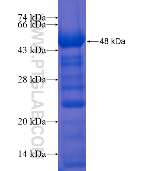 RASIP1 fusion protein Ag22036 SDS-PAGE