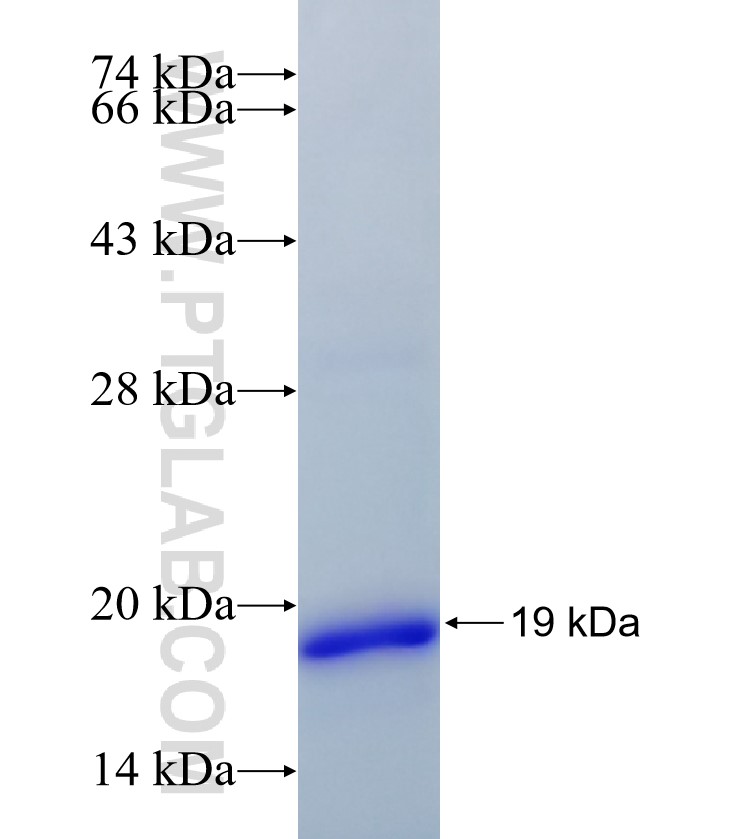 RASSF2 fusion protein Ag34707 SDS-PAGE RASSF2 fusion protein Ag34707 SDS-PAGE