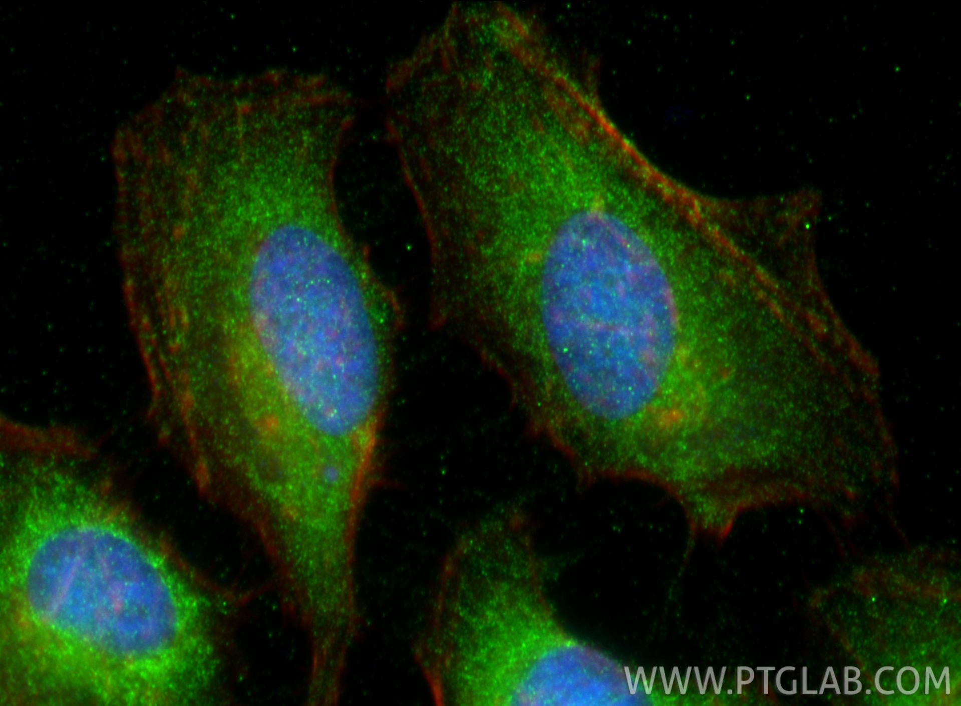 Immunofluorescent analysis of (-20°C Ethanol) fixed HeLa cells using RASSF3 antibody (26428-1-AP) at dilution of 1:400 and CoraLite®488-Conjugated Goat Anti-Rabbit IgG(H+L) (<a class='green' href='/productredirect?CatalogNo=SA00013-2' target='_blank'>SA00013-2</a>), CL594-Phalloidin (red). IF Staining of HeLa using 26428-1-AP