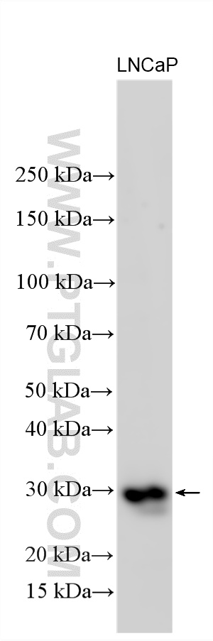 LNCaP cells were subjected to SDS PAGE followed by western blot with 26428-1-AP (RASSF3 antibody) at dilution of 1:1000 incubated at room temperature for 1.5 hours. WB analysis using 26428-1-AP